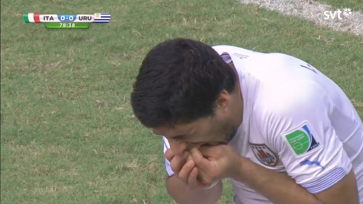 Suárez påstår att han fick ont i tänderna. 